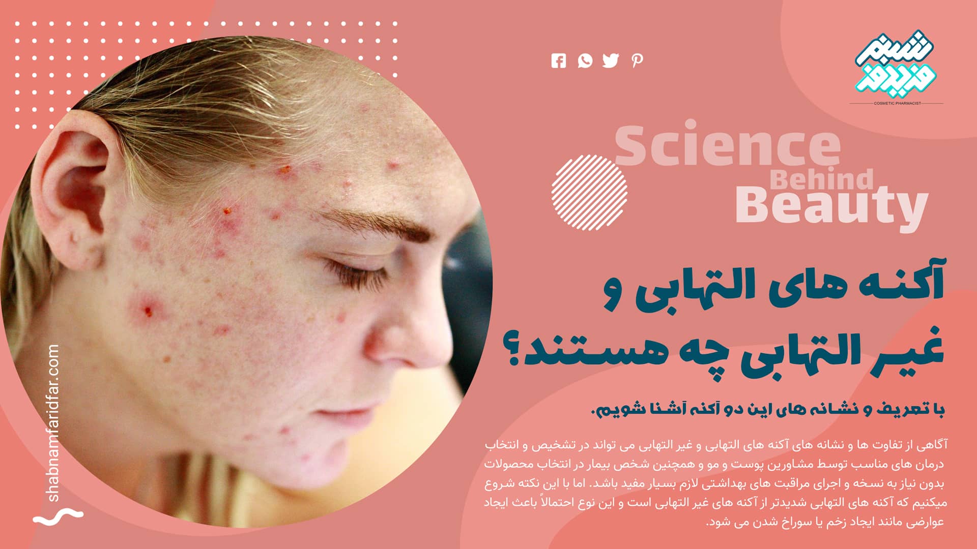 آکنه های التهابی و غیر التهابی
